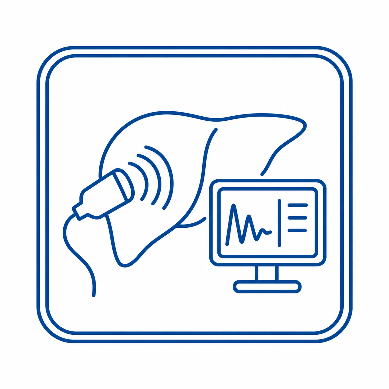 FibroScan