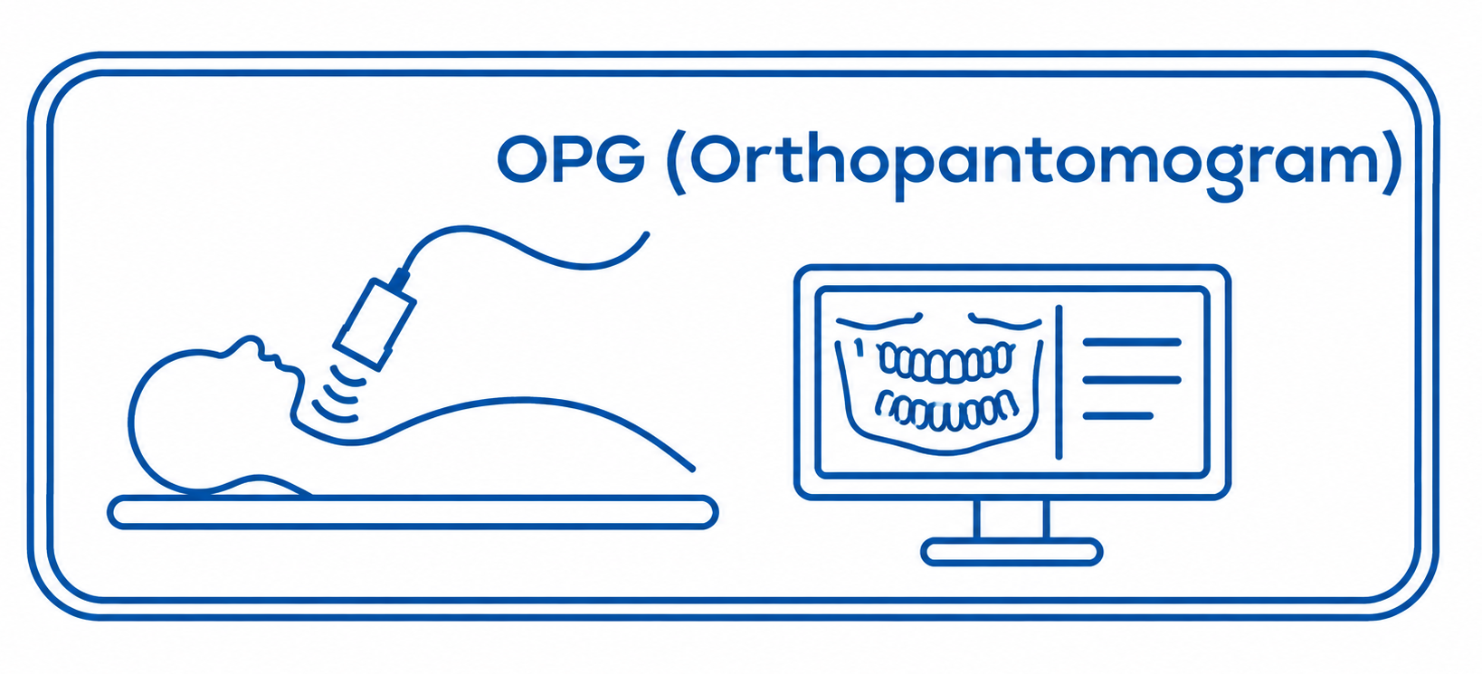 OPG (Orthopantomogram)